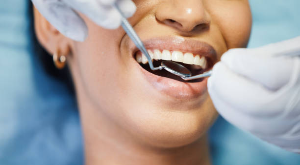 Best Emergency Dental Care for Abscessed Tooth in Paris, KY